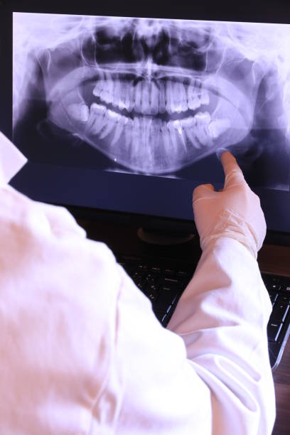 Best Emergency Root Canal Therapy in Centreville, MS